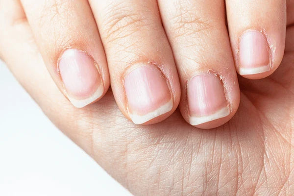 Breaking the Cuticle-Cutting Cycle: A Guide to Healing