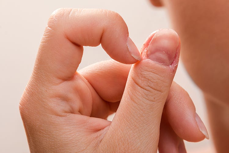 How To Stop Skin Picking On Fingers? 5 Simple Ways