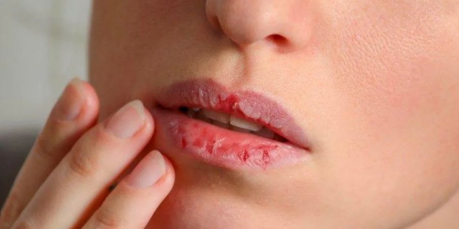 Tinted Trauma: How Longwear Lipsticks Quietly Damage Your Lips