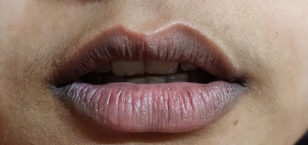 What’s Causing Your Dark Lips and How to Fix It Fast with Zanova