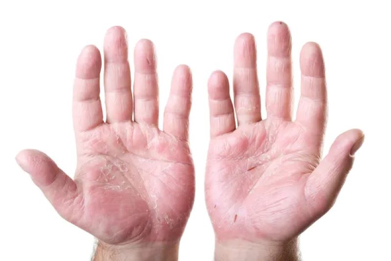 7-Day Skin Picking Recovery Plan | Zanova Hand Mask Guide