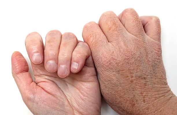 Why Your Hands Look Older Than Your Face (And the Easy Fix You’re Ignoring)