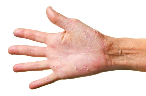 The Guilty Pleasure That’s Ruining Your Skin (And the 20-Minute Fix You’ll Obsess Over)