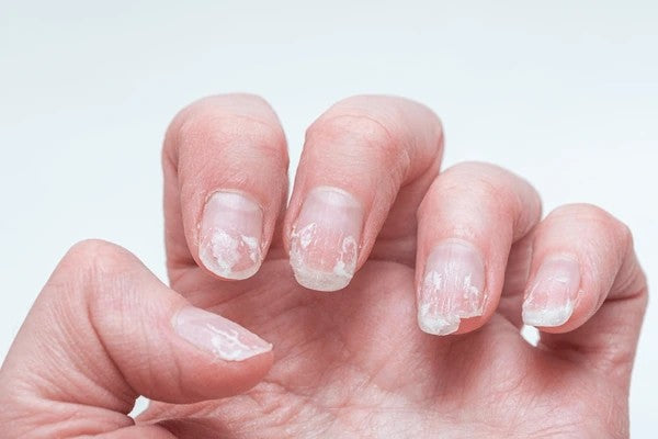 Rescue for Gel-Damaged Nails: How to Rebuild Strength Fast