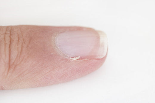 The Olive Oil + Collagen Combo: Your New Hangnail-Fighting Strategy