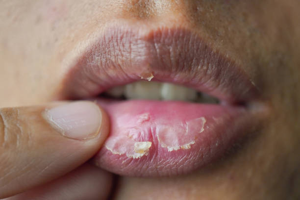 The Dark Side of Lip Care: 4 Habits That Make Your Lips Age Faster