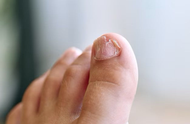Why ‘Spa Feet’ Are the Ultimate Anti-Picking Therapy (No Salon Needed)