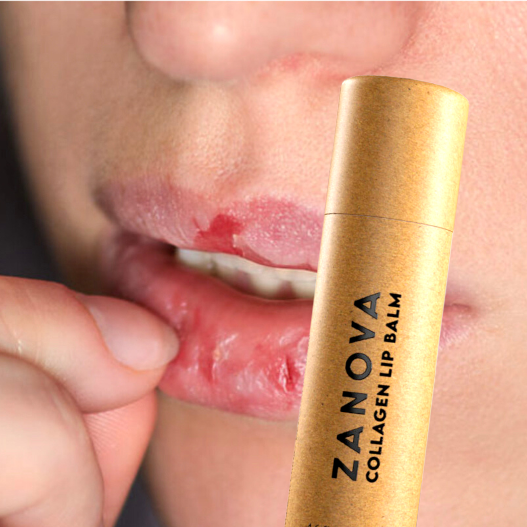 Zanova Collagen Treatment Lip Balm